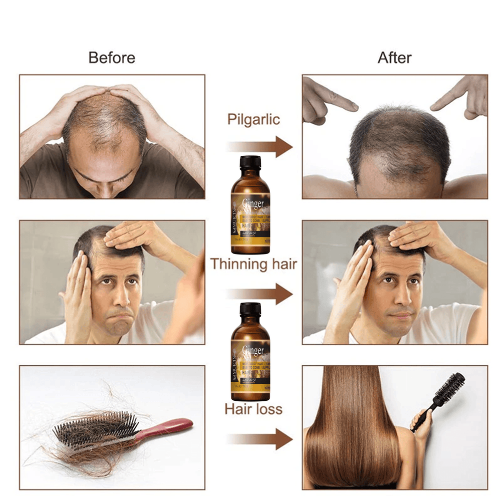MUICIN - GINGER ARAGAN OIL FOR HAIR FALL-50ML